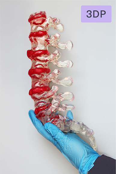 3dp-spine-match