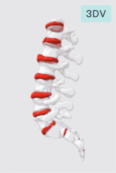 rotate-spine-3dv-lower-fast